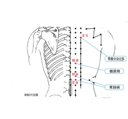 慢性肠炎理疗仪