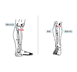 胃十二指肠溃疡理疗仪