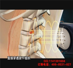 骨刺、骨质增生理疗仪