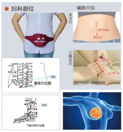 龙马痛经、闭经理疗仪