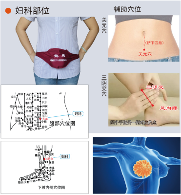 妇科龙马治疗仪